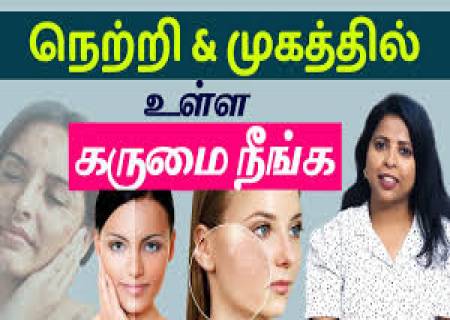 முகத்தில் உள்ள கருப்பு திட்டுக்கள் நீங்க 3 டிப்ஸ்