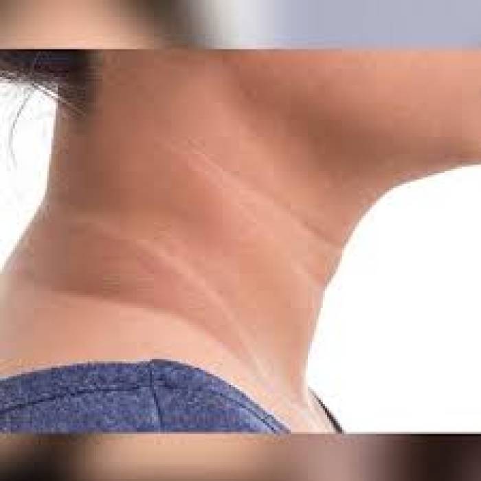 கழுத்தைச் சுற்றிலும் உள்ள கருப்பு  வளையம் போக...