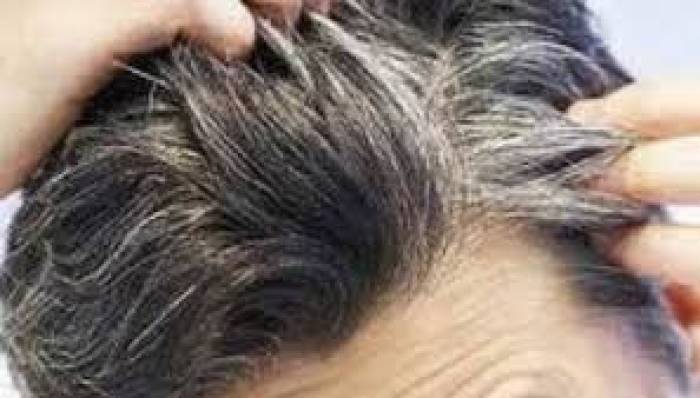 இளநரை போக....