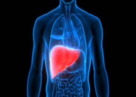 கல்லீரல் கொழுப்பு (Fatty Liver) – ஏன் ஏற்படுகிறது? 