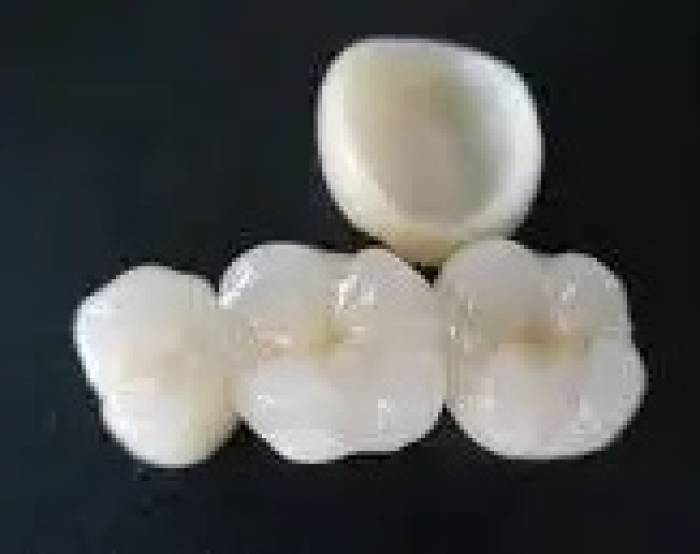 ஒளிவிடும் தன்மை கொண்ட உலோகம், சீர்கான்.