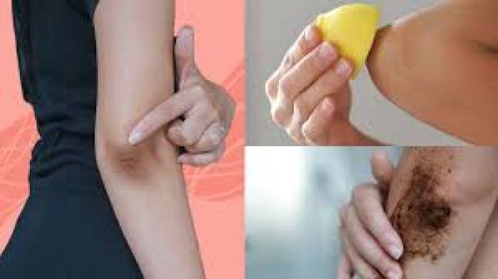 முழங்கை கருப்பாகவும், சொர சொரப்பாகவும் இருந்தால்....