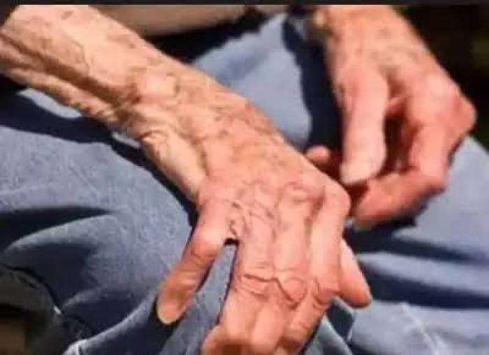 முதியோர்களுக்கு வரும் வலிப்பு நோய்.